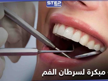 علامة بسيطة على الشفاه غير مبررة قد تكون دليل على الإصابة في سرطان الفم