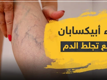 دواء أبيكسابان لمنع التجلط الدموي