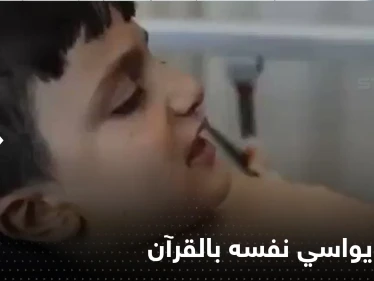 شاهد|| طفل سوري يواسي نفسه بقراءة القرآن الكريم أثناء تضميد جراحه بعد قصف مدينة الباب