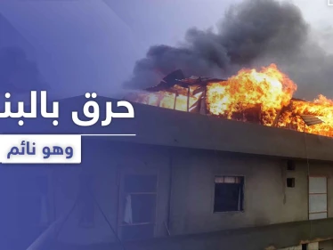 بالصور|| لاجئ سوري يتعرض للحرق بالبنزين خلال نومه وسط منزله في لبنان .. وهذا هو الفاعل