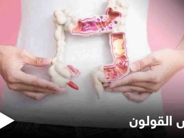 3 أمراض تصيب القولون تعرف على أعراضها وكيفية التفريق بينها