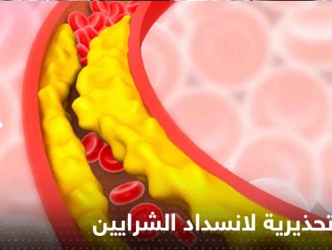 علامة تحذيرية بسيطة تكشف انسداد الشرايين بسبب الكوليسترول.. إياك تجاهلها