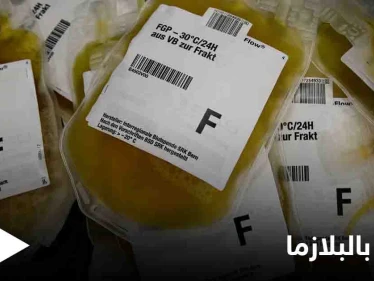 ما هو التبرع بالبلازما وآثاره الجانبية وأهم النصائح للمتبرع