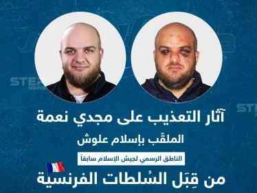 آثار التعذيب على مجدي نعمة الملقب بـ "إسلام علوش" من قبل السلطات الفرنسية