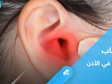 هل شعرت يوماً بـ "هواء في الأذن".. إليك الأسباب وطرق العلاج