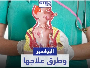أفضل علاج للبواسير في المنزل و الصيدليات