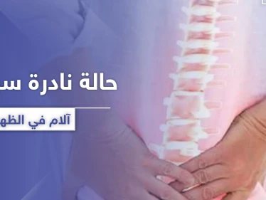سببت آلام في الظهر.. حالة نادرة لرجل تدهش الأطباء