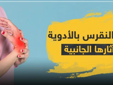 علاج النقرس بالأدوية وآثارها الجانبية