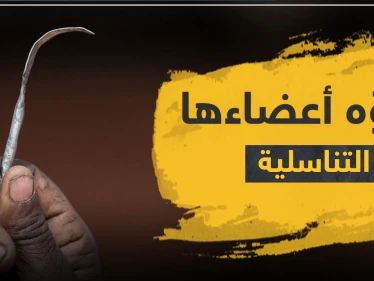 شوه أعضاءها التناسلية بعملية ختان.. طبيب مصري أمام المحكمة
