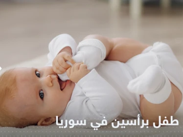 شاهد|| حالة طبية نادرة.. ولادة طفل برأسين في إدلب شمال سوريا
