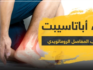 دواء أباتاسيبت لالتهاب المفاصل الروماتويدي