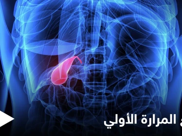 من أخطر الأمراض تشمع المرارة الأولي أسبابه وأعراضه وأهم المعلومات عنه