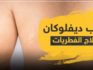 حبوب ديفلوكان لعلاج الفطريات