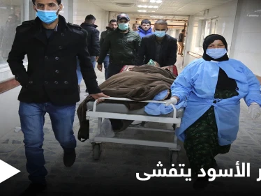 الفطر الأسود يُنهي حياة ضابطٌ رفيع وينتشر في محافظات عراقية