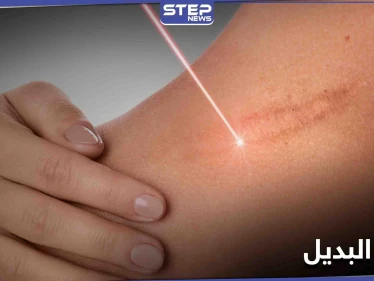 مسدس طبي.. اختراق يولد جلداً بديلاً ويغطي الحروق
