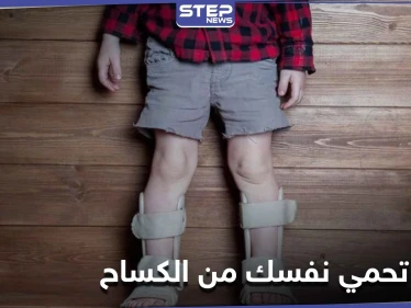 لين العظام.. كيف تحمي نفسك وأطفالك من خطر الإصابة بالكساح؟