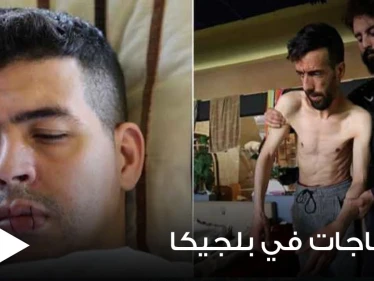 بالصور|| لاجئون في بلجيكا يخيطون أفواههم للإضراب عن الطعام احتجاجاً على أوضاعهم