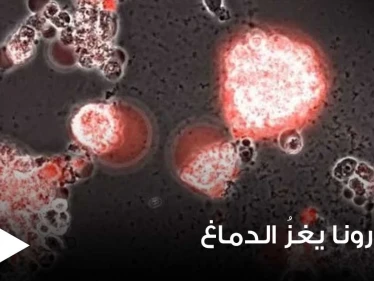 بالفيديو|| في تصوير نادر.. فيديو يوثق كيف يغزو فيروس كورونا خلايا الدماغ