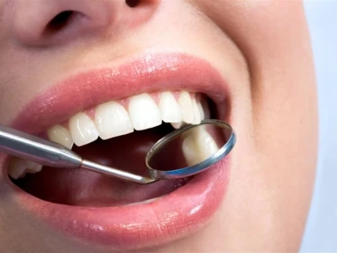 تجميل اللثة.. 4 أنواع رئيسي للعملية مع كافة التفاصيل والتكلفة والنصائح