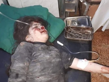 صور للقصف و الجرحى في بلدة كفرعويد بجبل الزاوية في ريف إدلب .