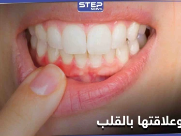 علامات تحذيرية غير معروفة موجودة في الفم قد تكشف أمراض القلب مبكراً