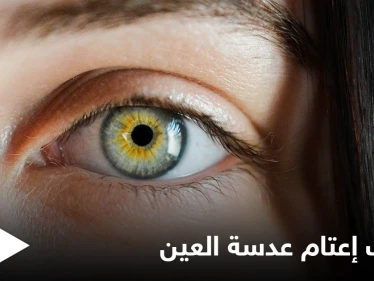 التدخين أحد أسبابه.. إعتام عدسة العين وخطورته وأبرز المسببات لحدوثه إليك اهم المعلومات