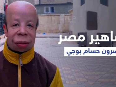 بالفيديو|| مشاهير مصر يناصرون قضية شاب مصري تعرض للتنمر ومعاناته تثير الجدل في البلاد