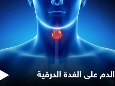 ما هي مخاطر وجود كيس الدم على الغدة الدرقية وأعراضه وطرق العلاج إليك أهم المعلومات