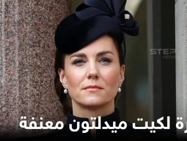 شاهد|| صورة للدوقة كيت ميدلتون معنفة بوجه مشوه تثير الجدل والغضب في بريطانيا
