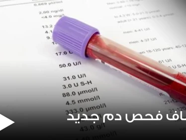 في اختراق عملي مذهل.. التوصل لفحص دم بسيط يكشف 50 نوعاً من السرطان