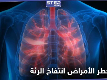 من أعراضه ضيق التنفس والإرهاق المستمر تعرف على مرض انتفاخ الرئة وطرق علاجه