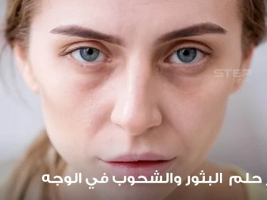 تفسير رؤية البثور والشحوب في المنام في الوجه وفي جميع أنحاء الجسم