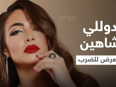 دوللي شاهين تتعرض للضرب المبرح وتنشر صور الكدمات التي ظهرت على وجهها وجسدها ومدير أعمالها يوضح (صور)