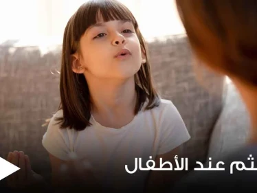 التلعثم عند الأطفال "التأتأة".. ما أسبابه وما هي طرق علاجه