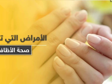 ما الأمراض التي تكشفها صحة الأظافر وألوانها وأشكالها في جسم الإنسان