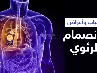 ماهو الانصمام الرئوي ومضاعفاته الخطيرة وعلاقته بالجلطة إليك أهم المعلومات