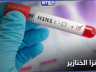 كندا تسجل أوّل حالة إصابة بمرض إنفلونزا الخنازير النادر تزامناً مع ارتفاع إصابات كورونا