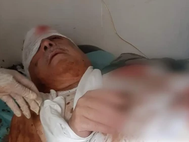 إصابة المسؤول الأول عن مجزرة البيضا بجراح بالغة نتيجة عبوة ناسفة!!