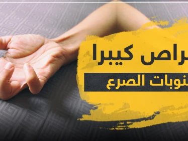 أقراص كيبرا لعلاج نوبات الصرع