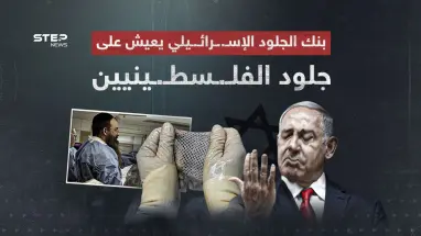 أثار الجدل في وسط حرب غـ..ـزة… ما هو بنك الجلد الإسرائيلي