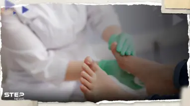 علامات على القدمين إذا شاهدتها يجب مراجعة طبيب لأنها "إنذار"