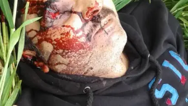 أبرز ناشطي درعا قتيلاً بظروف غامضة.. وأصابع الاتهام تشير إلى قوات النظام
