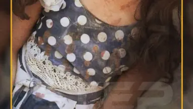 بثوب العيد مصاب وشهيد!!
