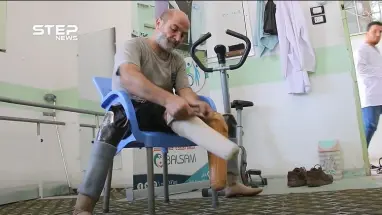 بطرفين صناعيين يتابع أحمد نمر حياته بشكل طبيعي متحدياً صعوبات الحياة ومرارة التهجير