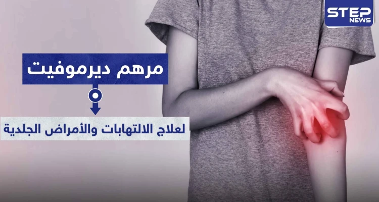 مرهم ديرموفيت Dermovate لعلاج الالتهابات والأمراض الجلدية