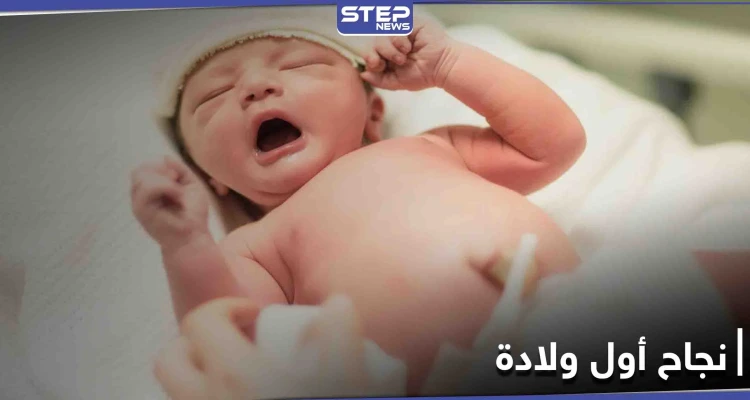 بشرى سارة للنساء... نجاح ولادة أول طفل من أم خضعت لـ زرع رحم بفرنسا