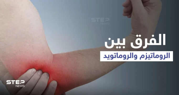 الفرق بين الروماتيزم والروماتويد.. إليك أهم المعلومات