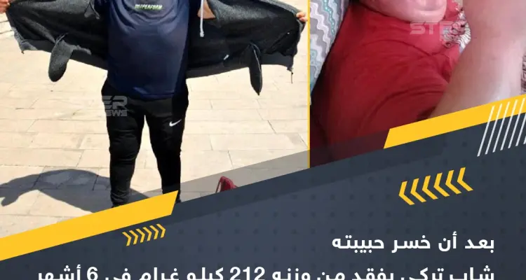 شاب تركي يخسر 212 كغ من وزنه باتباع نظام غذائي قاسِ: أخبار