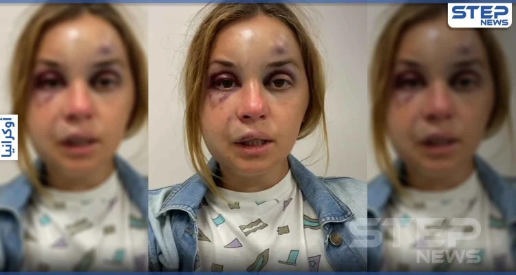 بالفيديو|| مذيعة أوكرانية تعرضت لضرب عنيف ومحاولة "اغتصاب" وتكشف كيف تمكنت من الهرب