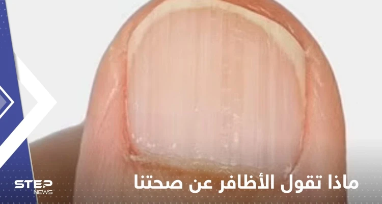 ماذا تقول الأظافر عن صحتنا؟.. تعرف على الحالات الخطيرة